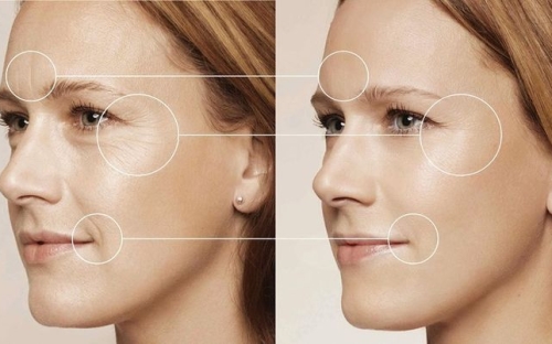 Dịch vụ đặc biệt: Nâng cơ trẻ hóa – Xóa nhăn-Giảm mỡ Bụng