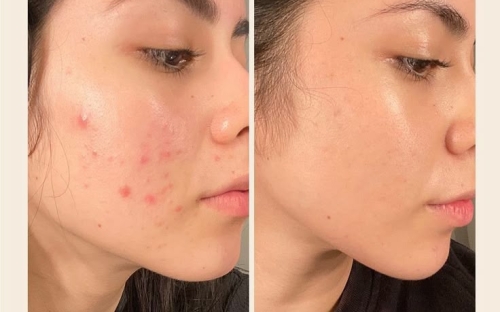 Dịch vụ điều trị da chuyên sâu