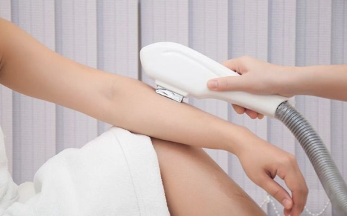 Dịch vụ triệt lông